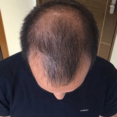 Before