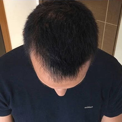 After